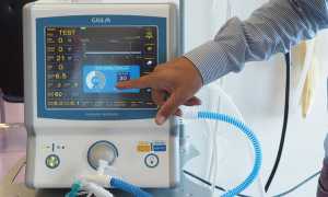 ventilatore neonatale