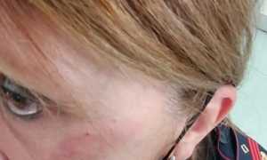 vercelli agente polizia ferita